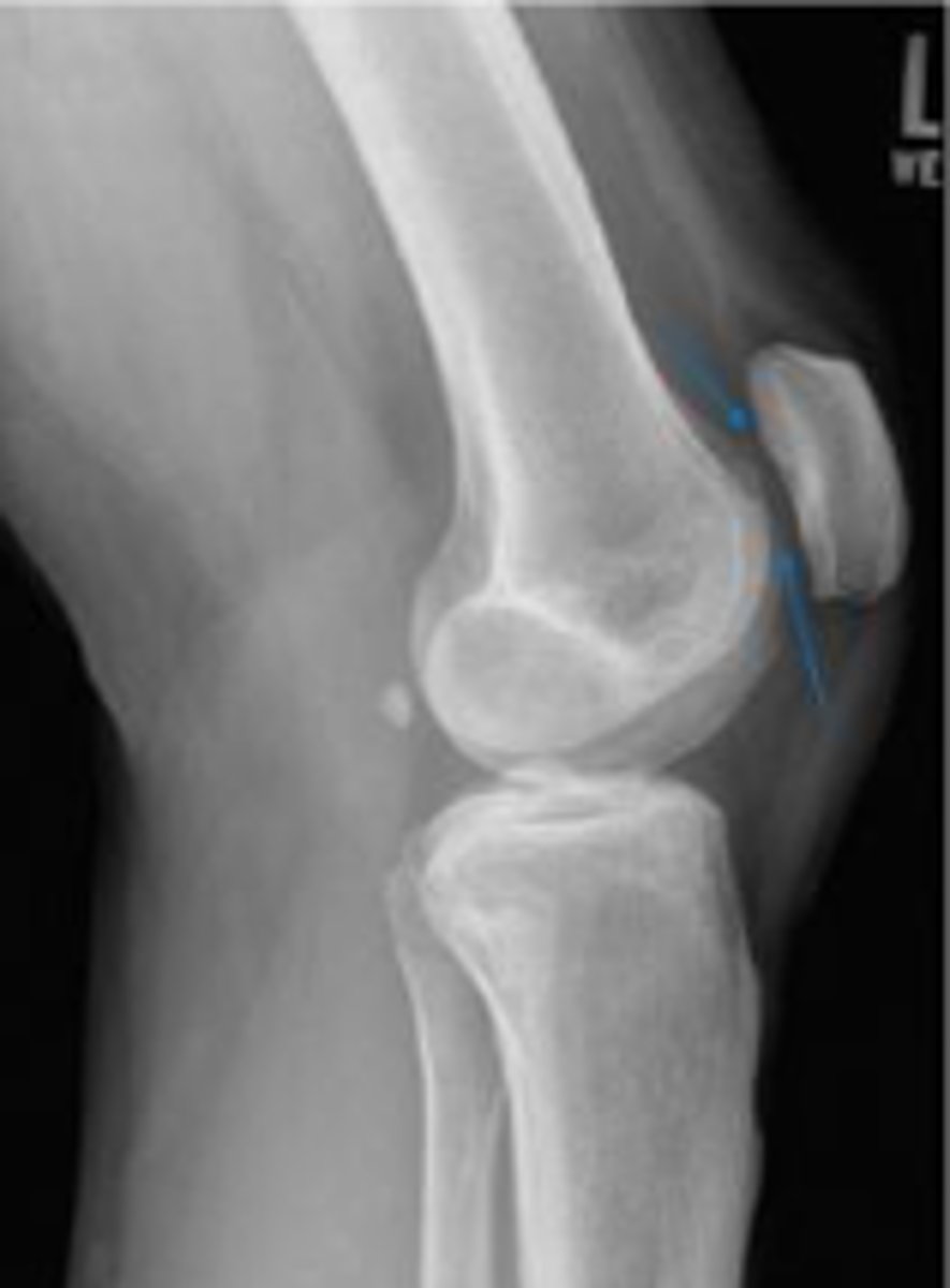 <p>What space are the arrows pointing to?</p>