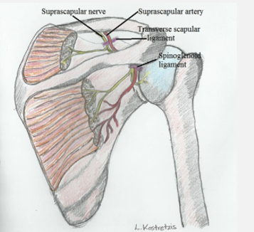 <p>Suprascapular Nerve Palsy- Sites of entrapment </p>