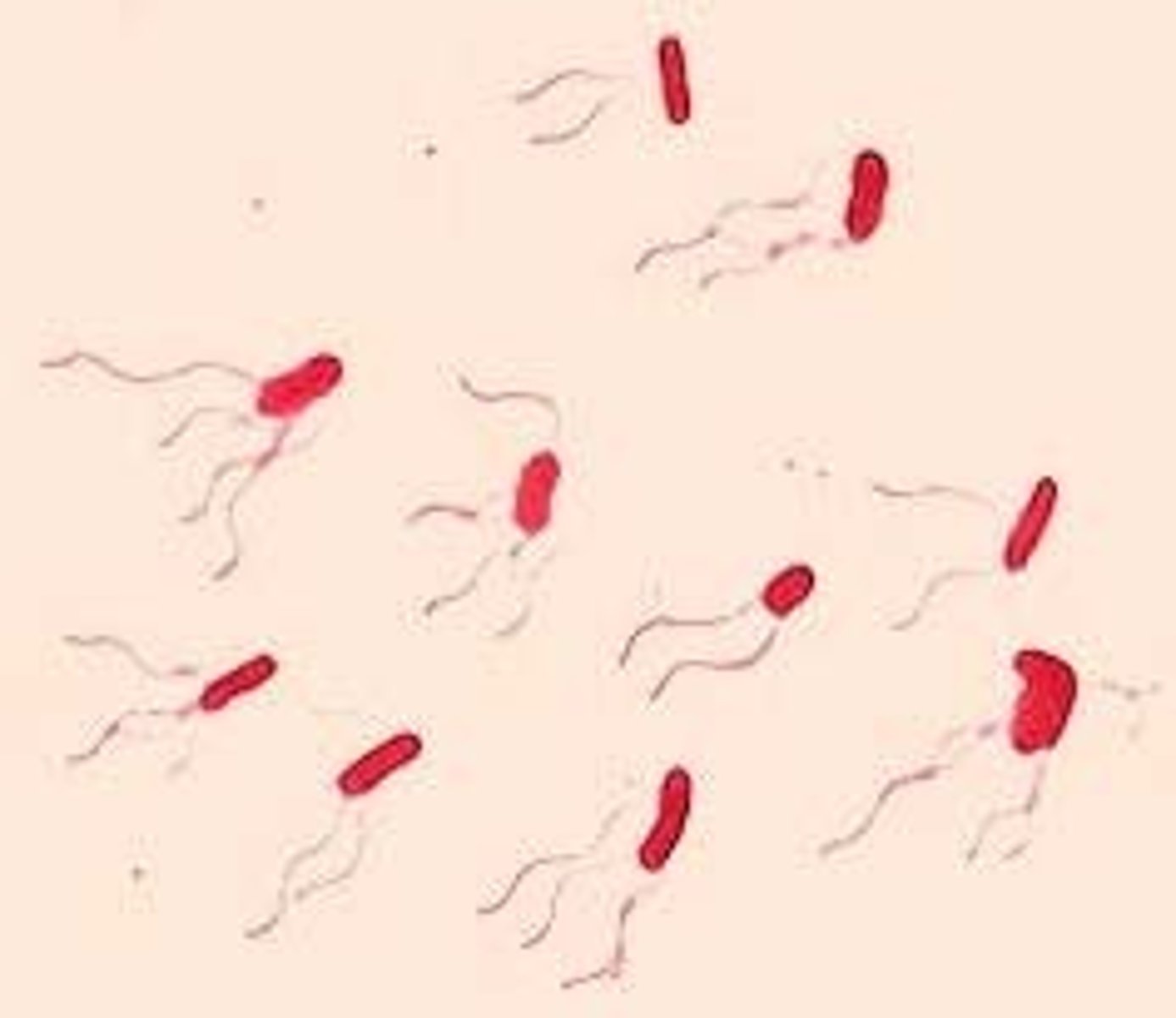 <p>What cellular structure is stained here?</p>