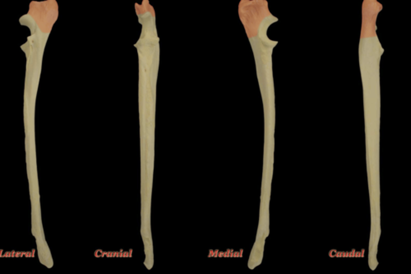<p>What structure is highlighted in this picture?</p>