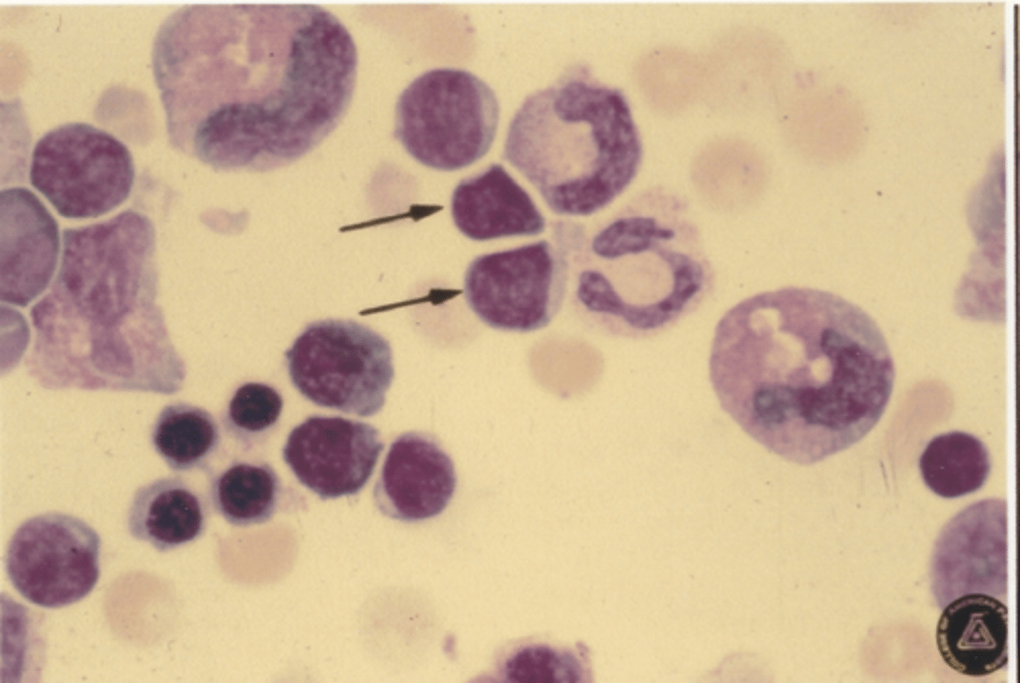 <p>Identify the cells in this body fluid</p>
