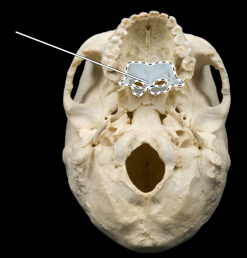 <p>Name this bone.</p><p>(Skull, inferior view).</p>
