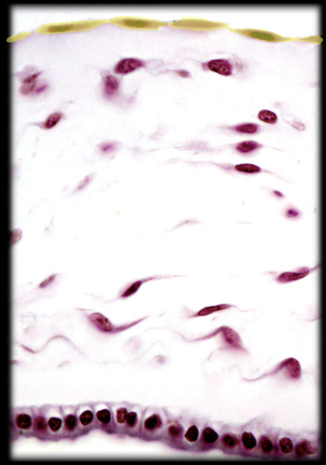 <p>Simple squamous epithelium</p>