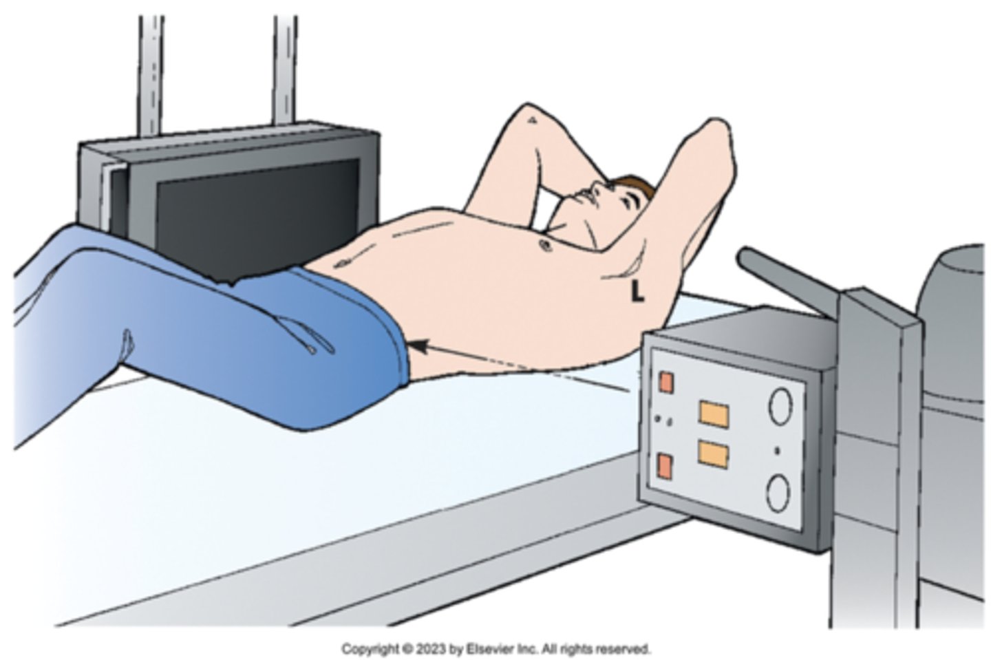 <p>patient is supine &amp; horizontal beam is used</p><p>Right X radiographic position of abdomen results in right lateral projection. Note horizontal orientation of central ray.</p>