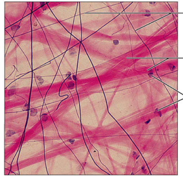 <p>areolar</p>