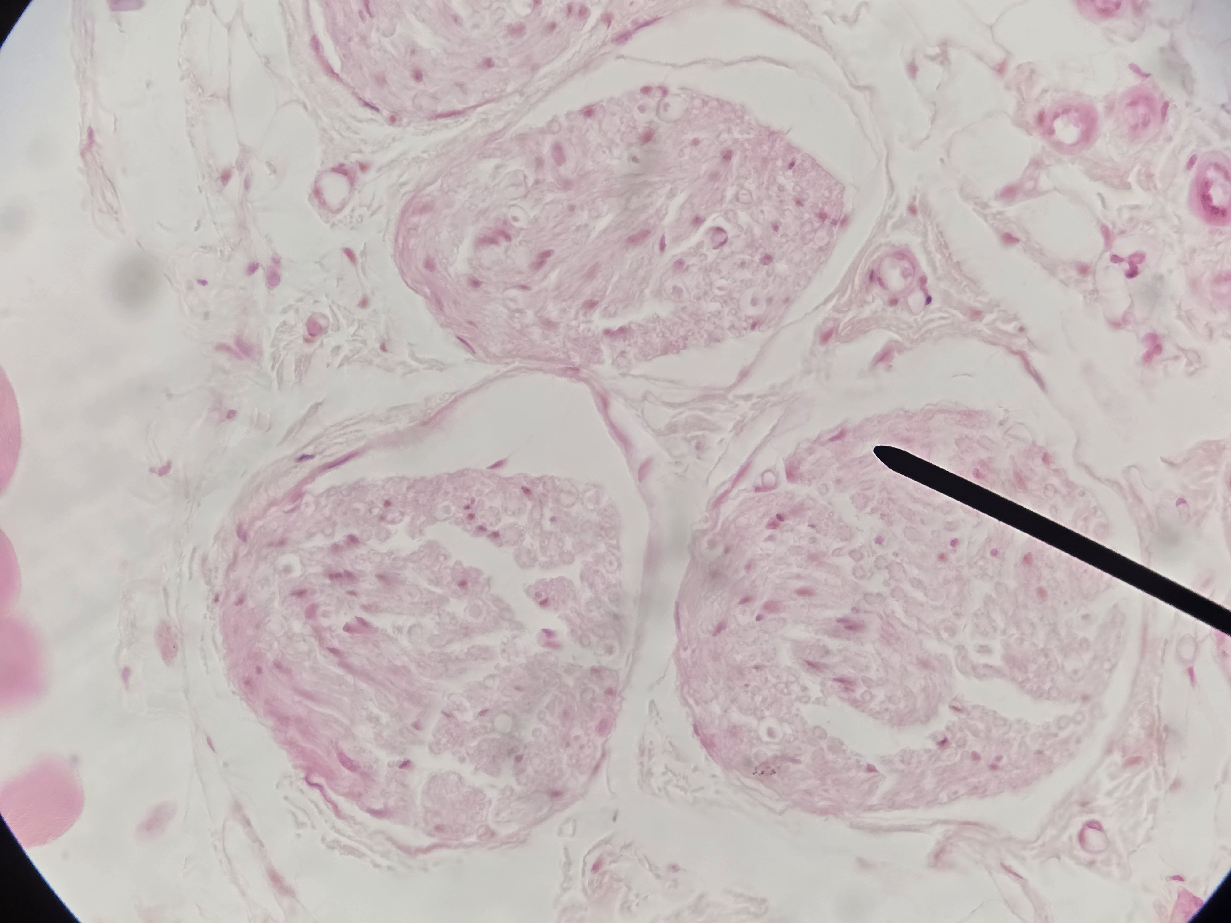 <p>Name Connective Tissue Layer</p>