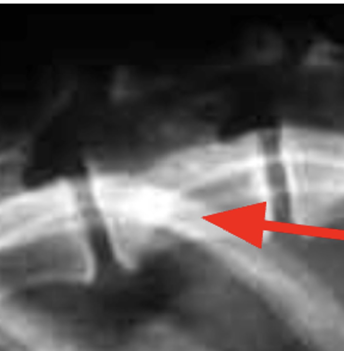 <p>What is the anatomical structure indicated?</p>