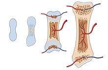 Replacement of cartilage cells and matrix with bone cells and matrix
