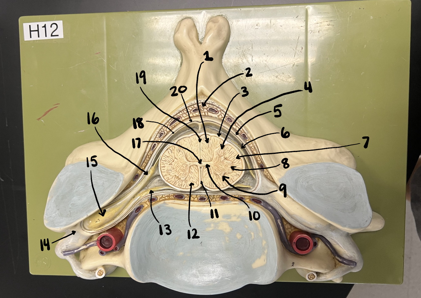 <p>18</p>