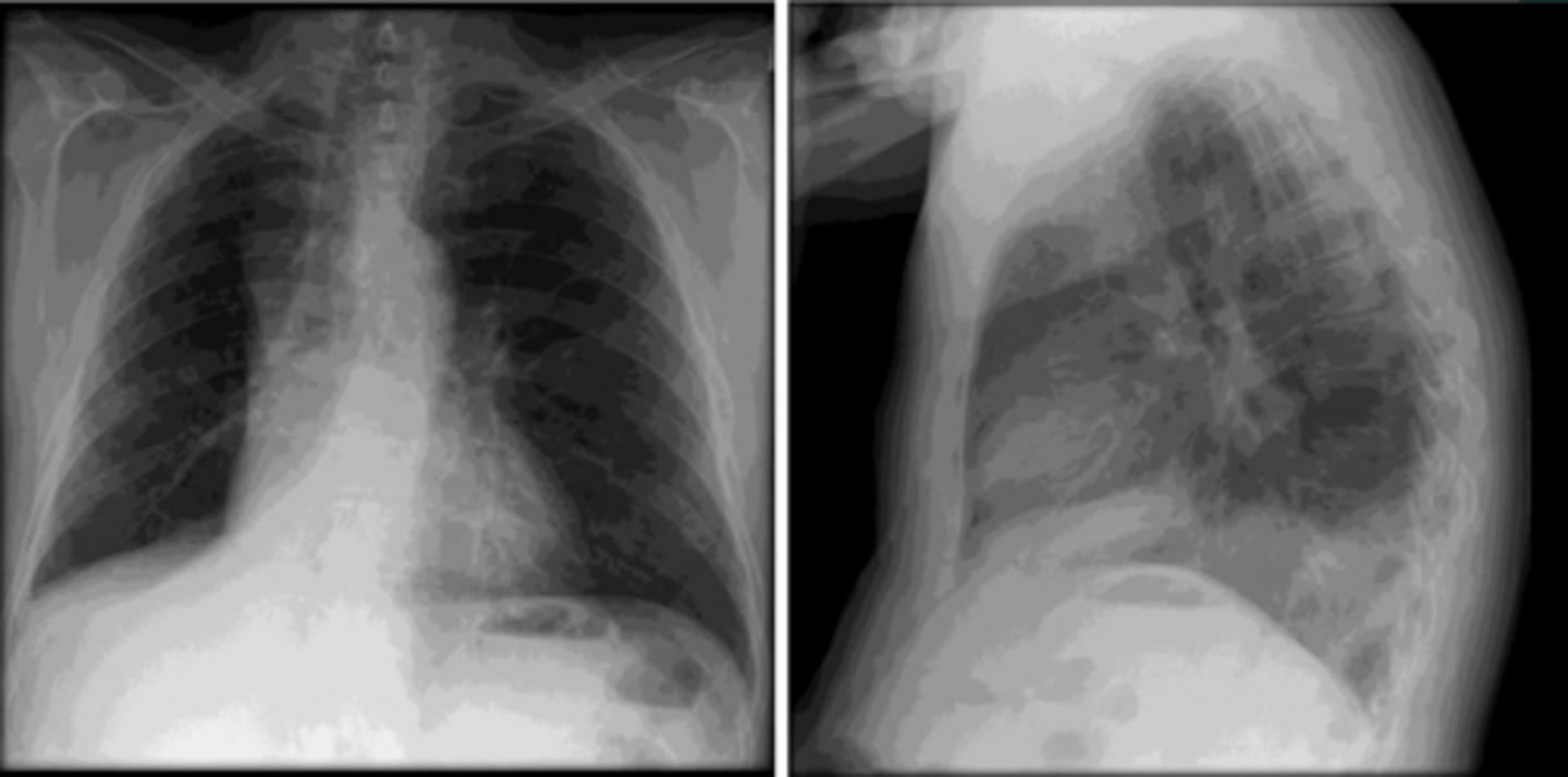 <p>What is the diagnosis?</p>