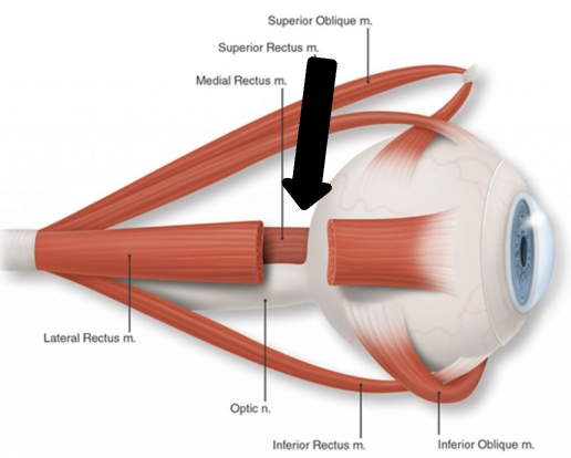 <p>innervation: CN III</p>