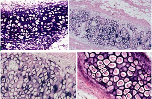 <p><strong>Elastic cartilage connective tissue</strong></p>