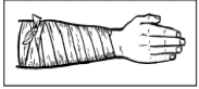 <p>use this for a large cylindrical area such as a forearm, upper arm, calf, thigh. The spiral wrap is used to cover an area larger than a circular wrap can cover</p>