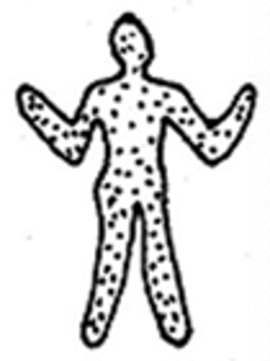 <p>generalized distribution</p>