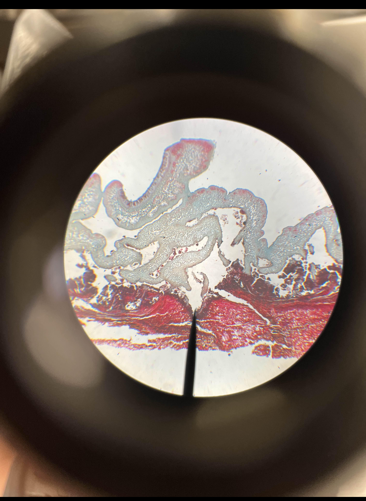 term image