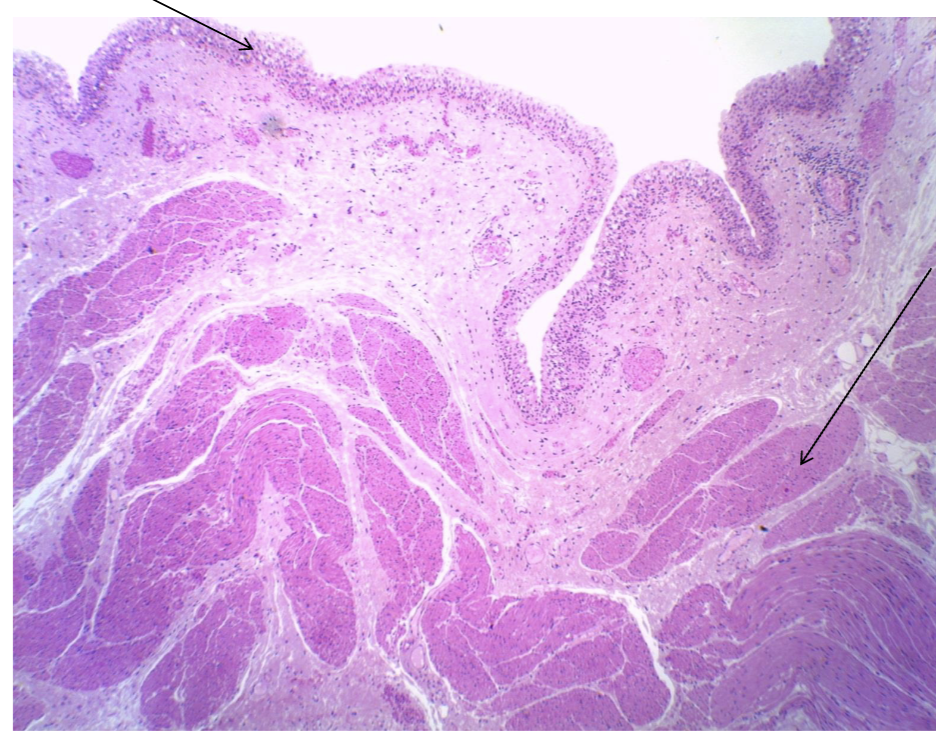 <p>what is the tissue?</p>