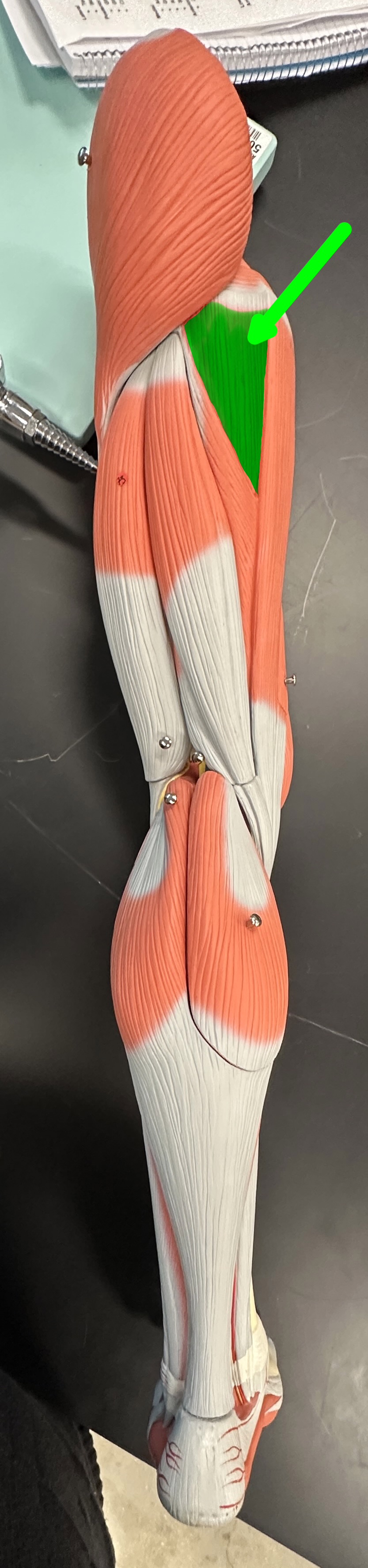 <p>What is the highlighted structure</p>