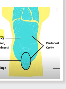 <p>the SPACE located directly within the abdominopelvic cavity </p>