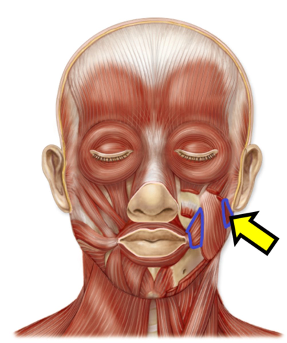<p>Name the muscle.</p>