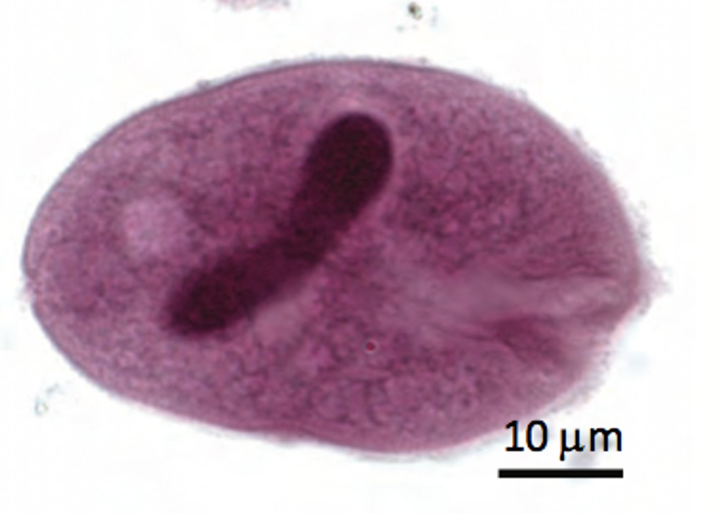 <p>ciliate</p>
