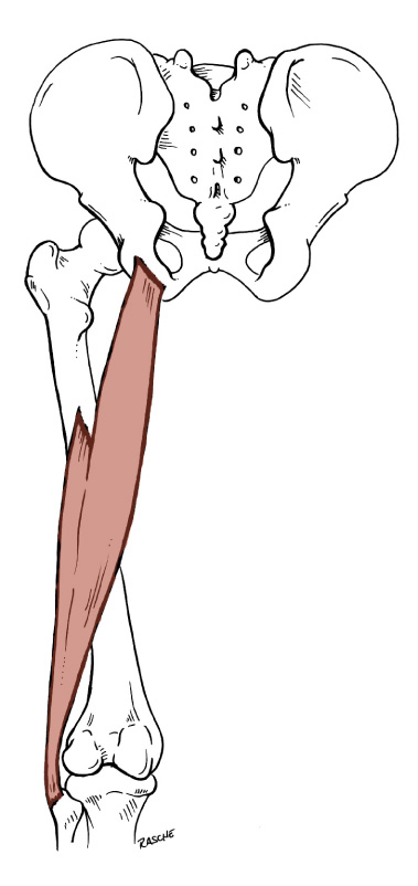 <p>Origin: <span>Long head: ischial tuberosity; Short head: lateral lip of the linea aspera</span></p><p>Insertion: <span>Head of Fibula and lateral condyle of the Tibia</span></p><p>Action: <span>extends the thigh, flexes the leg</span></p>