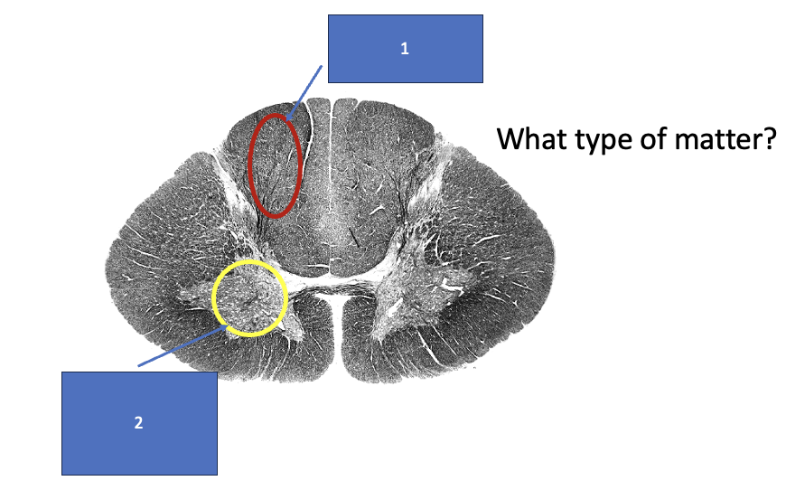 <p>What structure is labeled 2?</p>