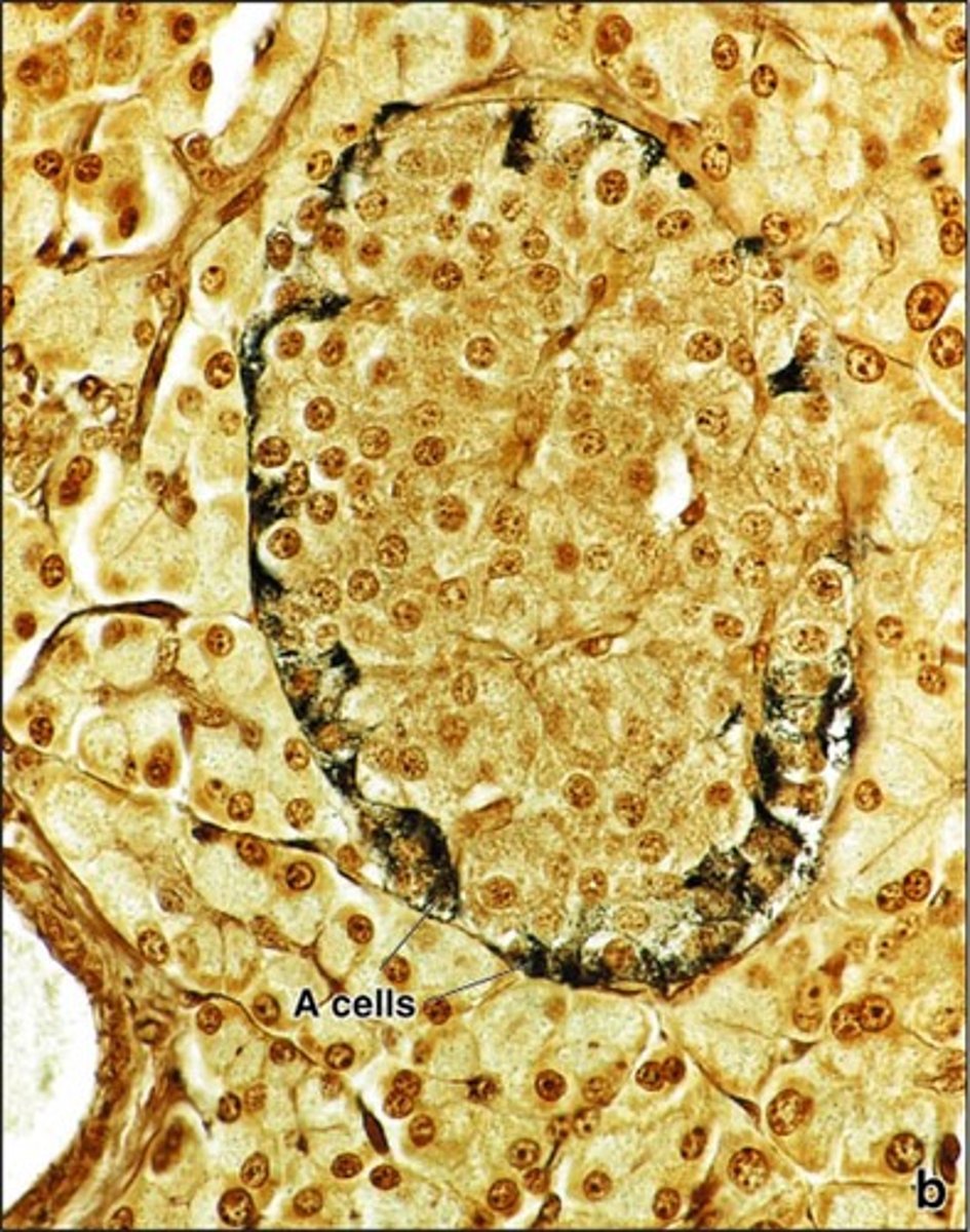 <p>grimelius silver stain</p>