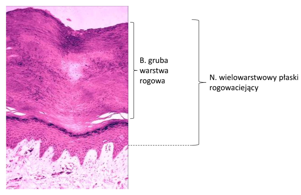 <p>np. powierzchnia ciała kręgowców (naskórek), grzbietowa powierzchnia języka, dziąsła (ochrona podczas żucia)</p>