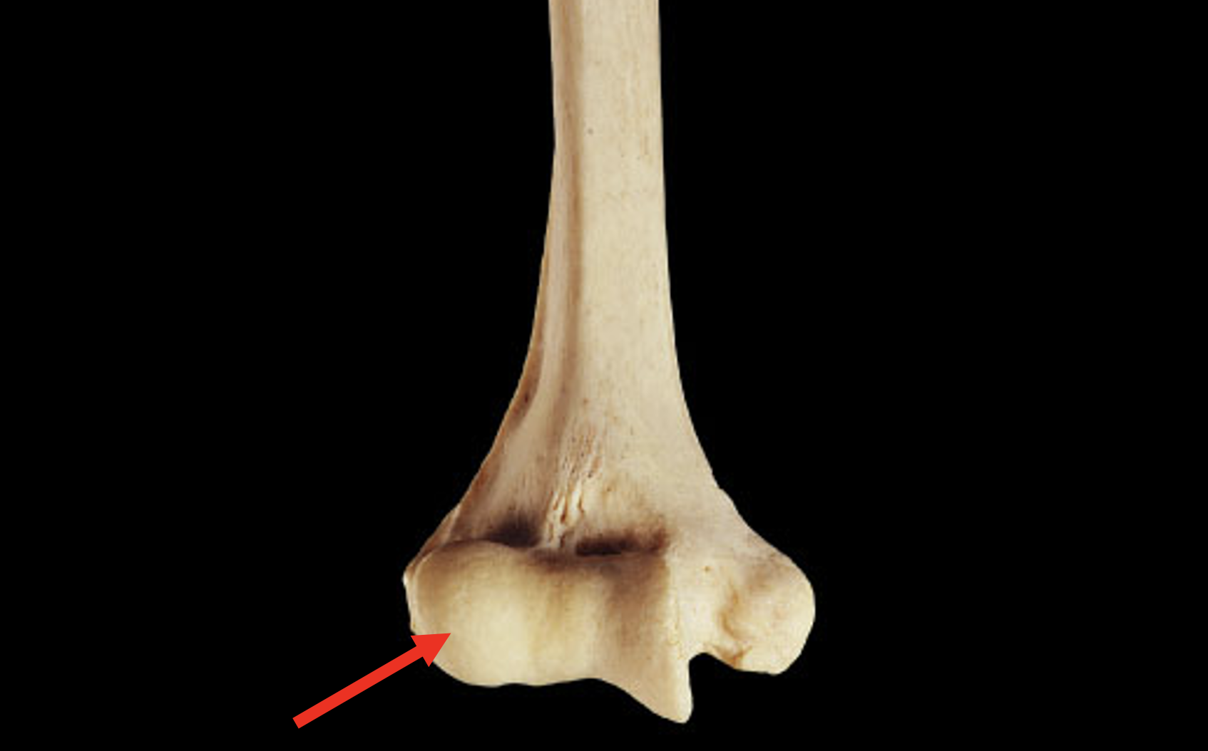 <p>Name this region of the humerus</p>