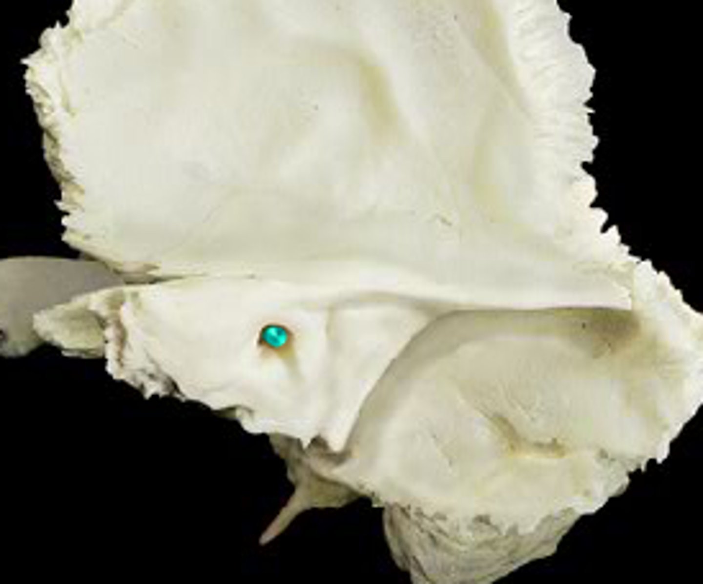 <p>Continuous w/ Stylomastoid Foramen</p>