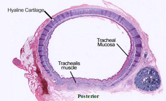 <ul><li><p><span>Facing lumen → <u>ciliated pseudostratified columnar epithelium</u></span></p><ul><li><p><span>Goblet cells secrete mucus</span></p></li></ul></li><li><p><span><strong>Lamina propria of the mucosa:</strong> contains areolar loose CT</span></p></li><li><p><span>Anterior trachea → rings of hyaline cartilage</span></p></li><li><p><span>Posterior trachea → smooth trachealis muscle</span></p></li><li><p><span>Inferior to trachea: esophagus</span></p></li></ul><p></p>