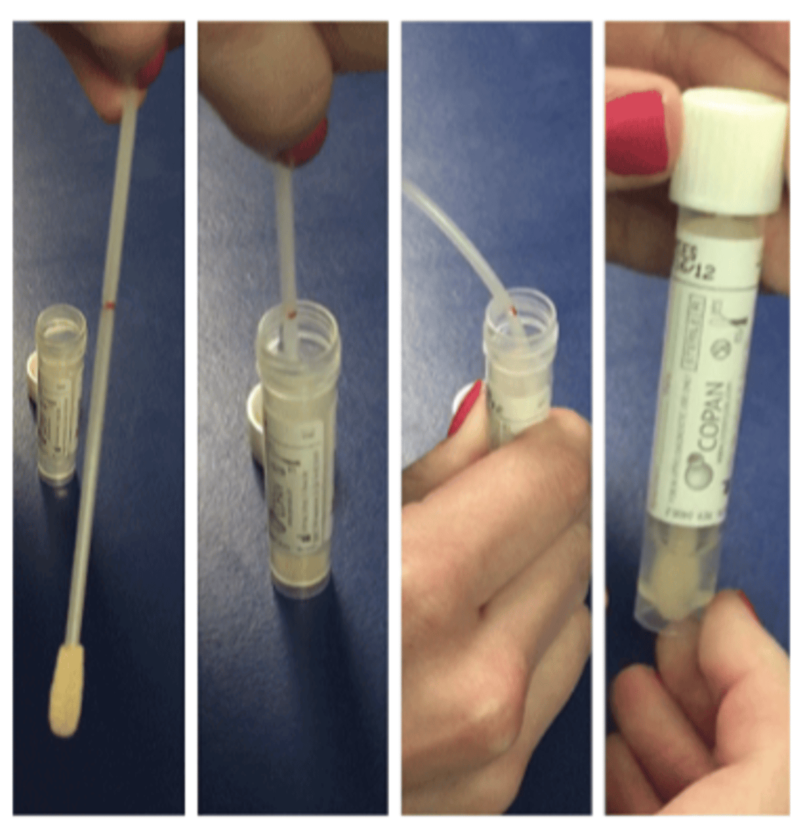 <p>What is the benefit to the one touch method over a traditional plating method?</p>