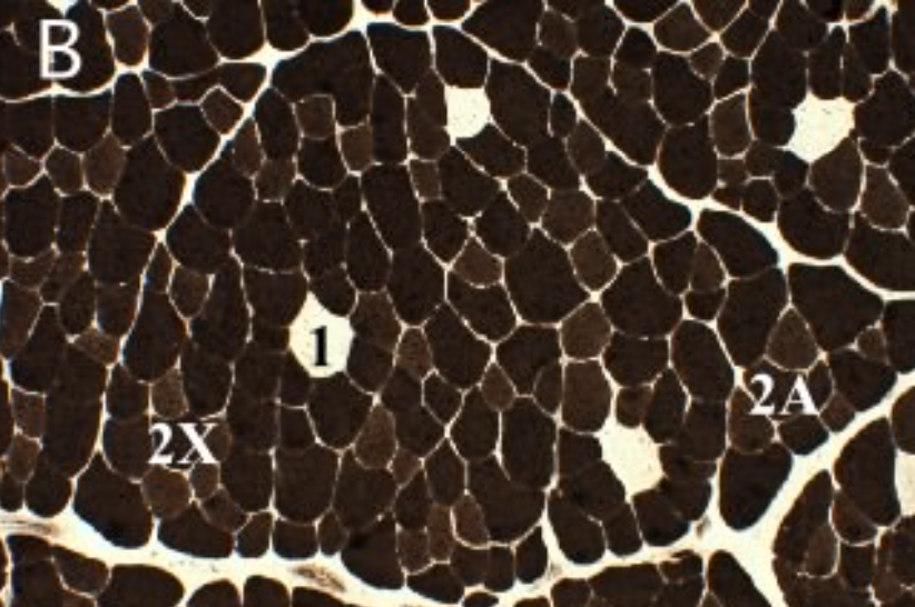 <ul><li><p>On the head of the myosin molecule, an <strong>enzyme hydrolyzes ATP</strong> to breakdown the ADP and Pi</p></li><li><p>Able to <strong>identify a muscle that has a lot of ATPase </strong>(fast twitch) and muscle that has <strong>very little ATPase </strong>(slow)</p></li></ul>