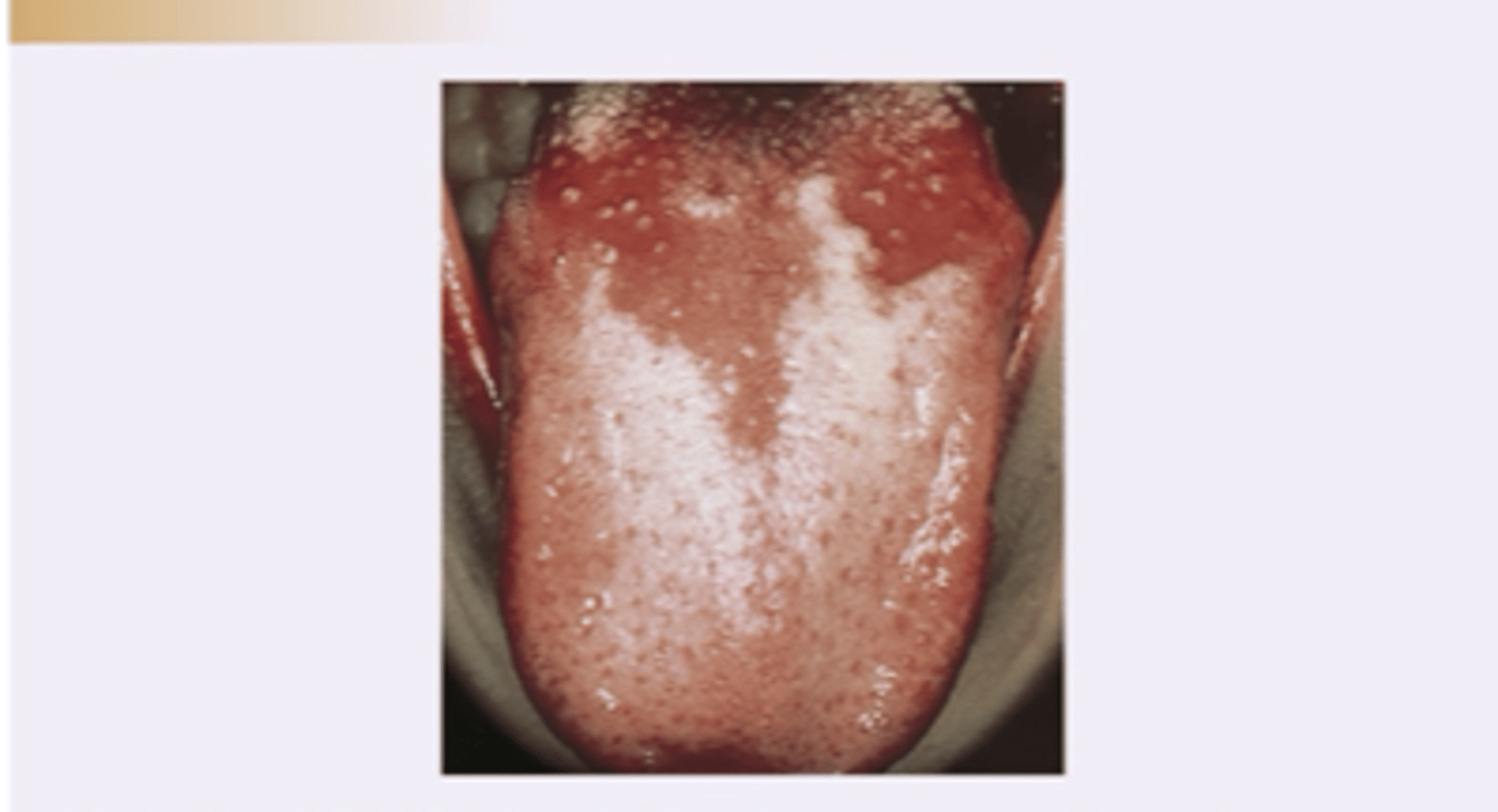 <p>Diagnosis?</p>
