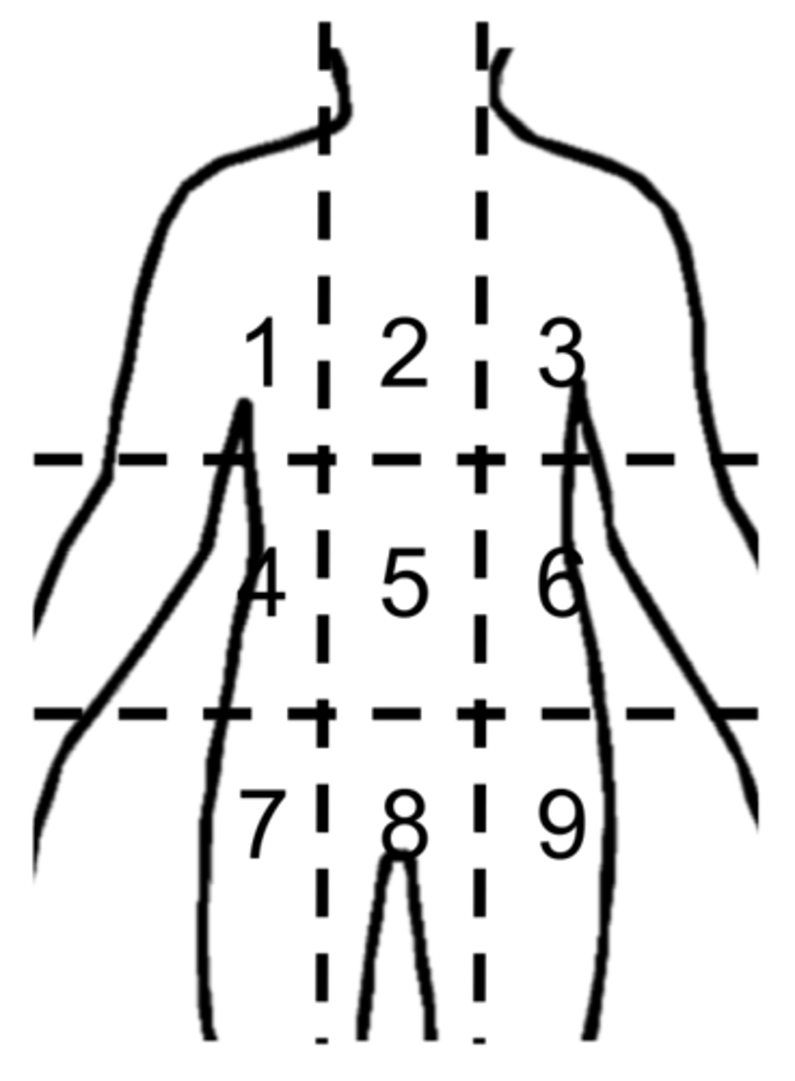 <p>#8</p>