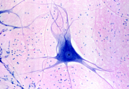 term image