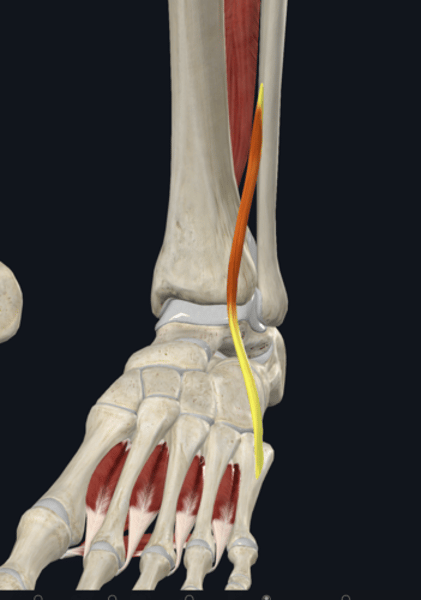 <p>name the yellow highlighted muscle </p>