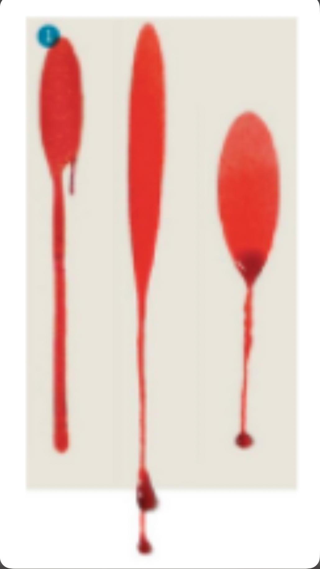 <p>What type of spatter pattern is shown</p>
