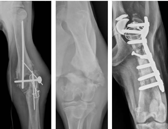 <p><span>Due to ischemic event&nbsp;(e.g., fracture, surgery) and concurrent bacterial colonization.</span><br><br><span>Systemic host risk factors are hypovolemia, malnutrition, obesity, endocrine diseases, and immunosuppression.&nbsp;</span><br><br><span>Local host risk factors are unstable fracture, tissue metabolism, foreign material, and dead space.</span></p>