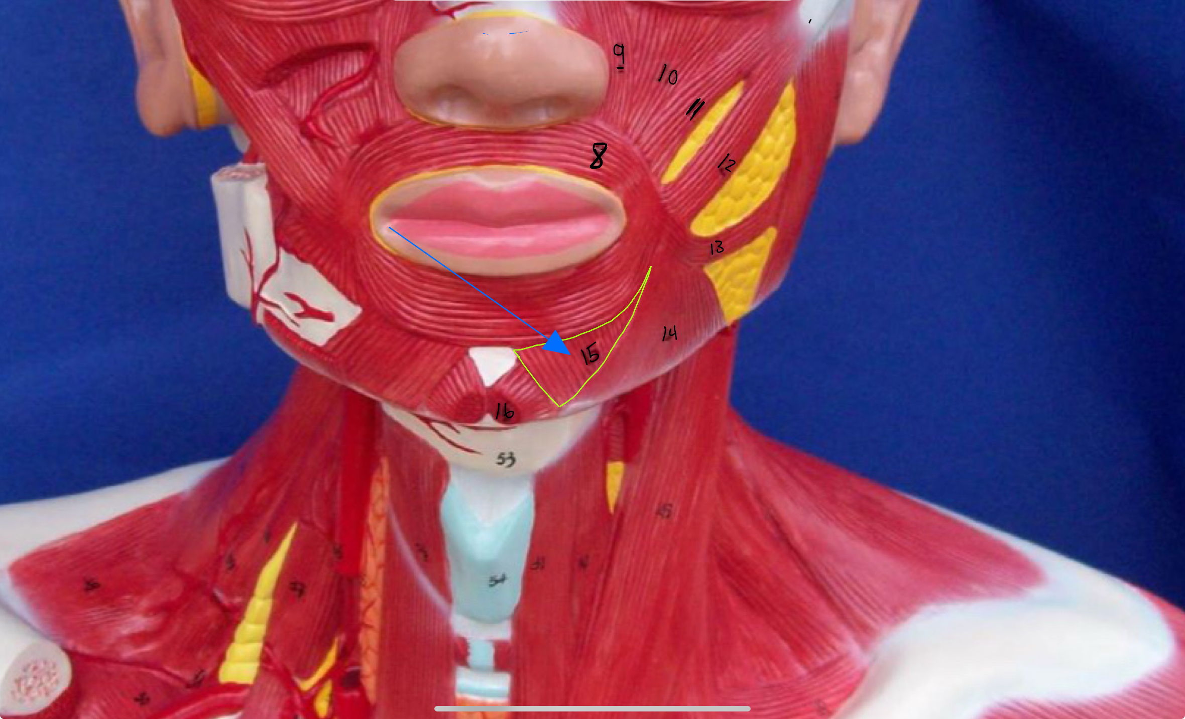 <p>What type of muscle is this (altay model )</p>