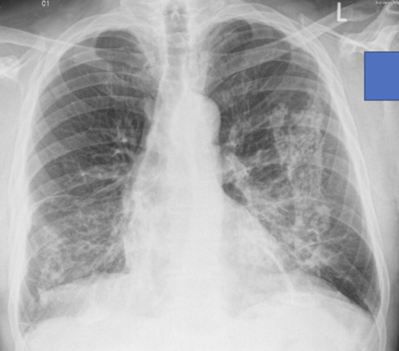 <p>What abnormality do you see here? Which disease is this?</p>
