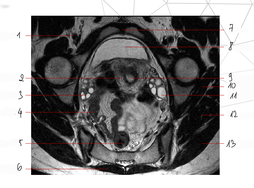 <p>Mốc gp, chuỗi xung, thì</p>