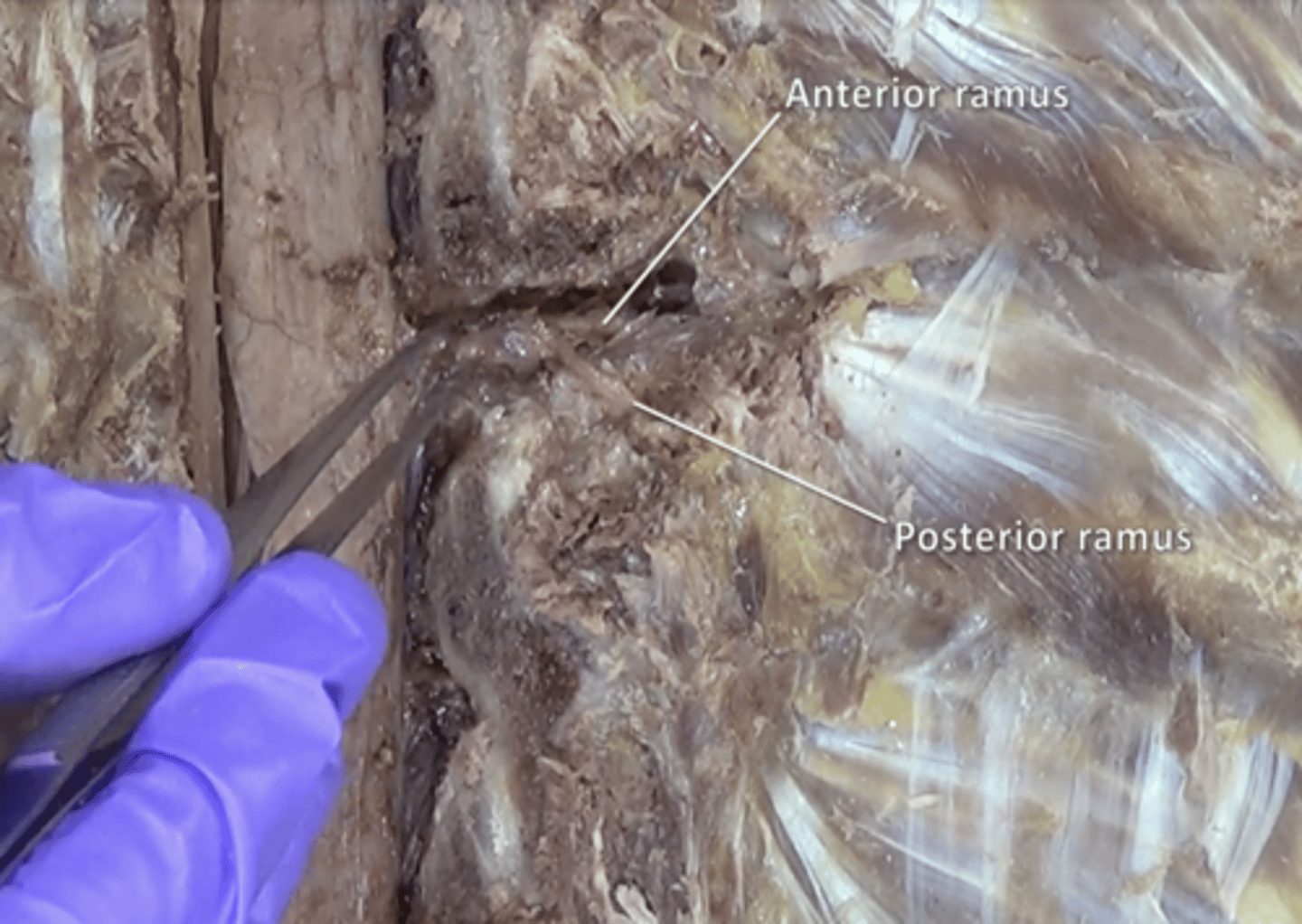<p>travel anteriorly to supply the muscles of the upper and lower limbs, the anterior thorax and abdomen, and part of the back</p>