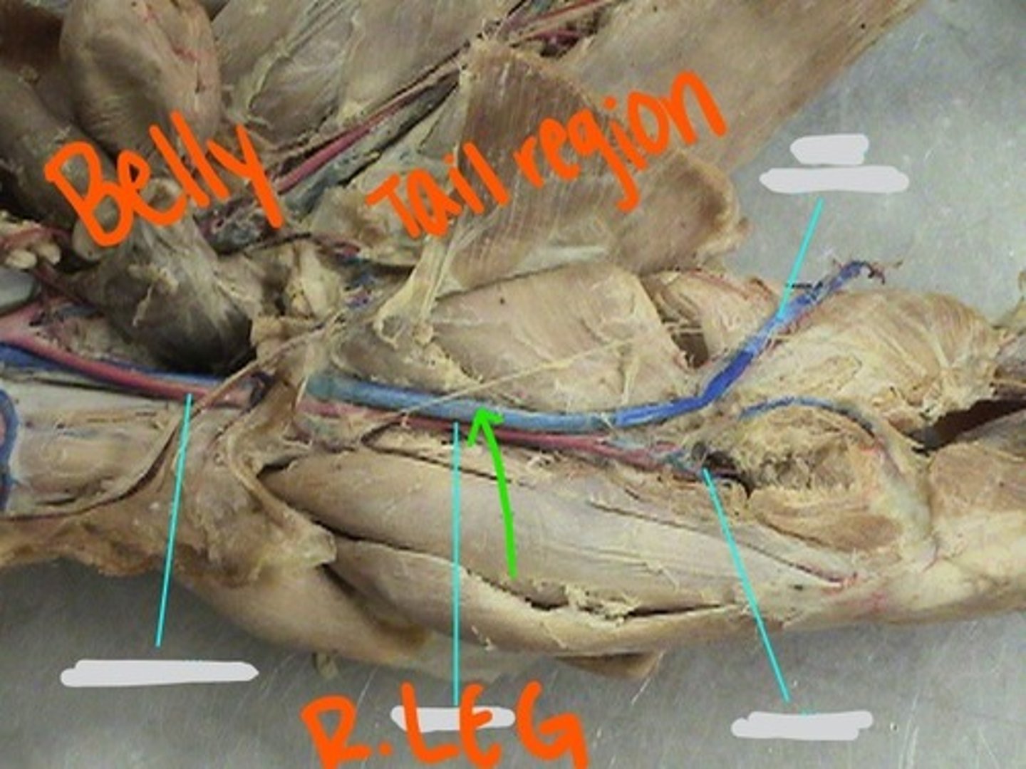 <p>identify this vein</p>