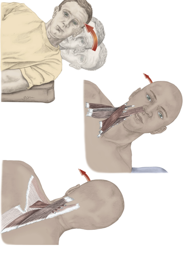 Cervical Lateral Flexion