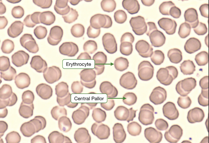 <p>basically, a red blood cell </p>