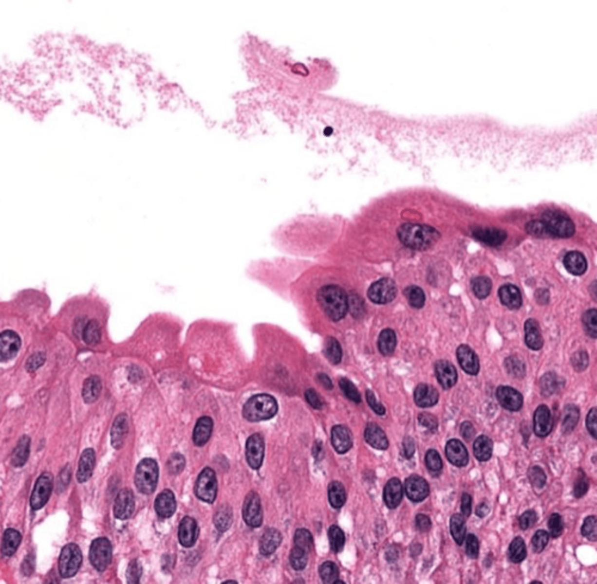 <p>Cells that have two nuclei.</p>