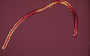 <p>Identify the urine sediment element shown:</p>