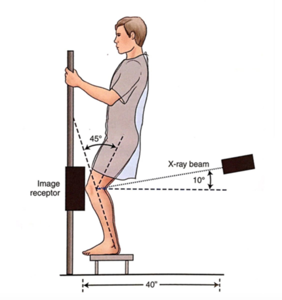 <p>Pt erect</p><p>provide step stool for some pt so they are high enough for CR to be 10 degrees caudad</p><p>feet straight ahead and weight evenly distributed</p><p>knee flexed 45 degrees</p>