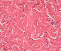 <p>fibers are in randomized directions; increases strength when pulled in multiple directions, less in one direction</p><ul><li><p>able to <strong>withstand tension</strong> exerted in MANY directions; provides structural strength</p></li><li><p><strong>dermis of the skin</strong>, submucosa of digestive tract; fibrous capsules of organs and of joints</p></li></ul><p></p>